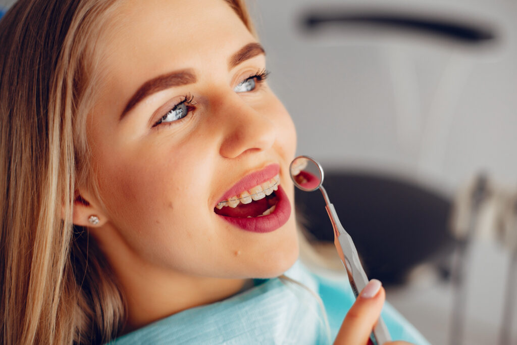 faccette dentali